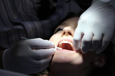 Overcoming gag reflex at the dentist