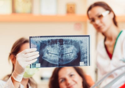 three women looking at an x-ray of teeth