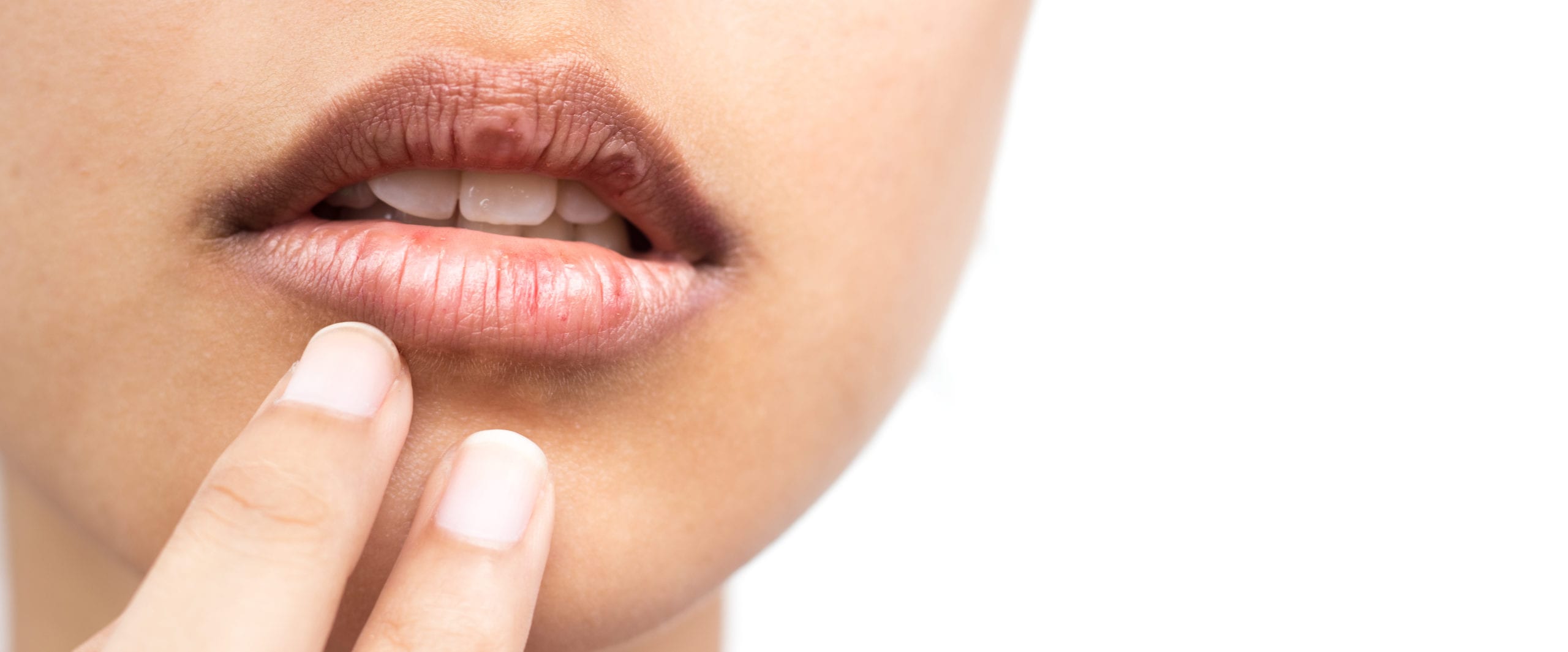 dry-mouth-remedies-tips-for-controlling-dry-mouth-all-smiles-care