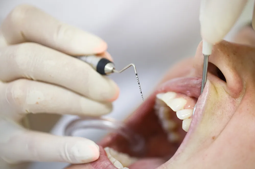1. A person brushing their teeth with a toothbrush, focusing on dental hygiene during a cleaning session.