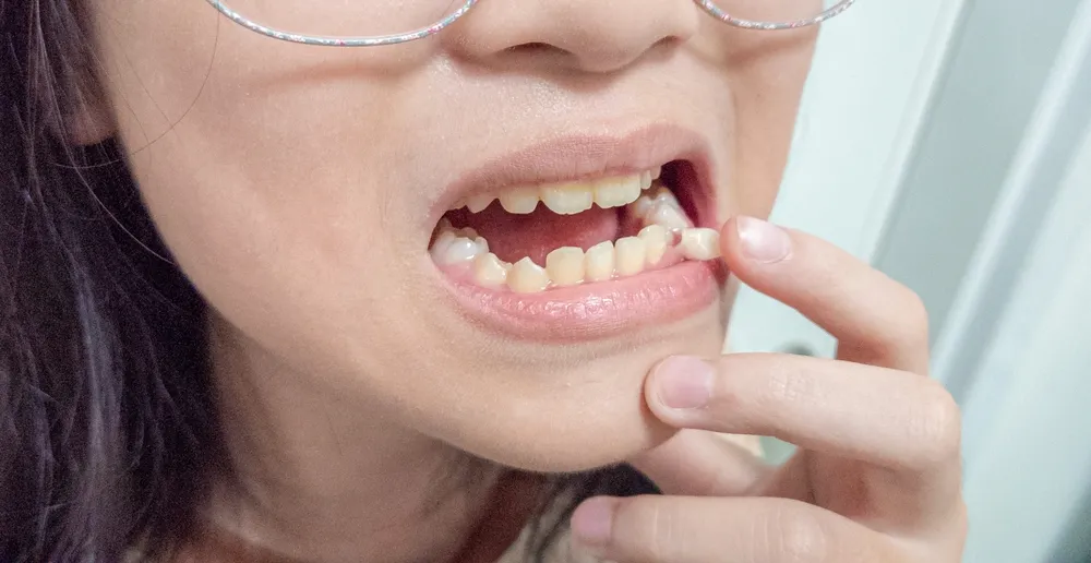 1. A woman wearing glasses smiles, revealing her teeth, showcasing a confident and cheerful expression.