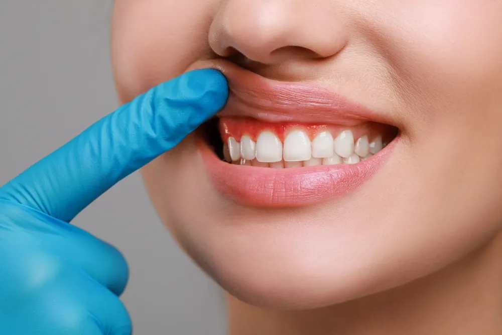 A woman wearing blue gloves holds a toothbrush, preparing for a dental cleaning or hygiene demonstration.
